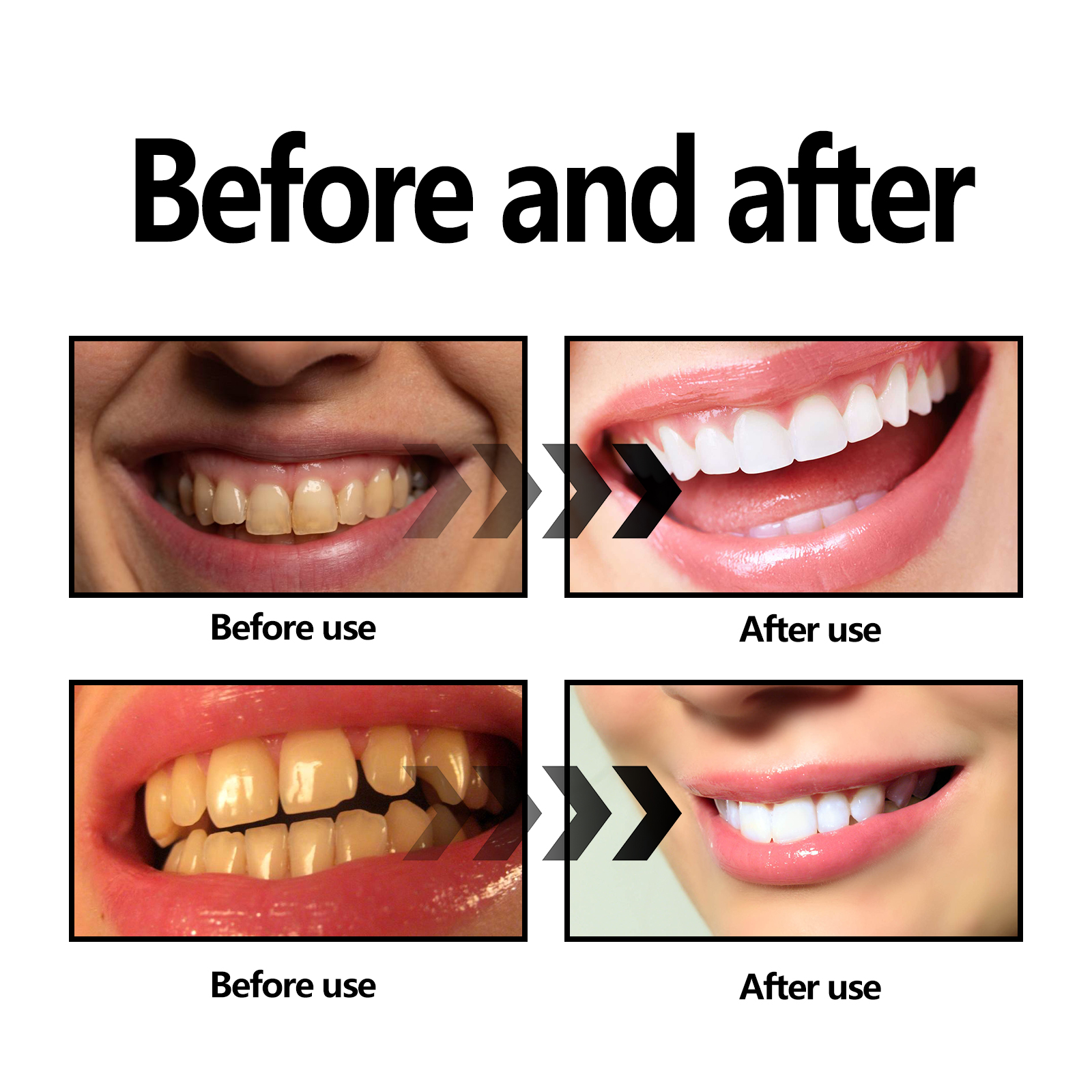 Activated Coconut Charcoal Too - đánh giá và giá Teeth Whitening Charcoal Powder