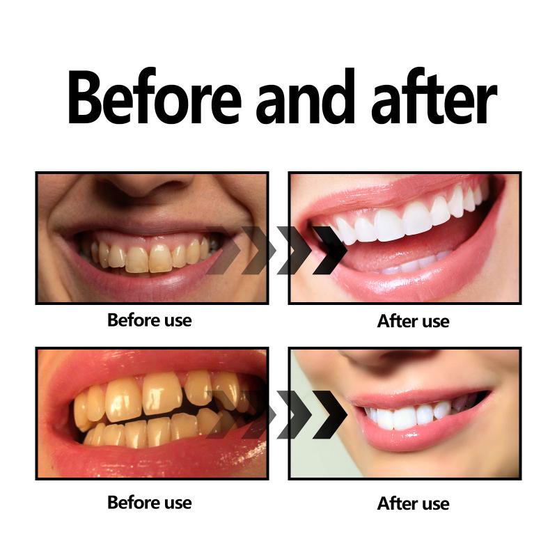 Teeth Whitening Powder Charcoa - đánh giá và giá Teeth Whitening Charcoal Powder