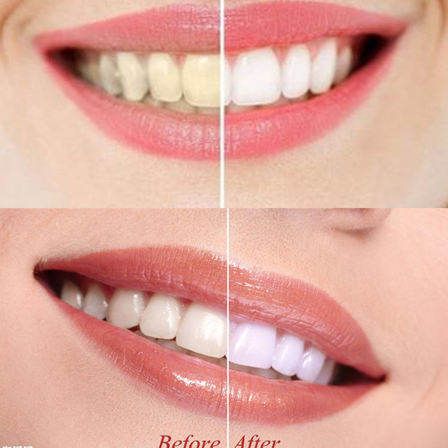 Bamboo Charcoal Teeth Tooth De - đánh giá và giá Teeth Whitening Ingredients