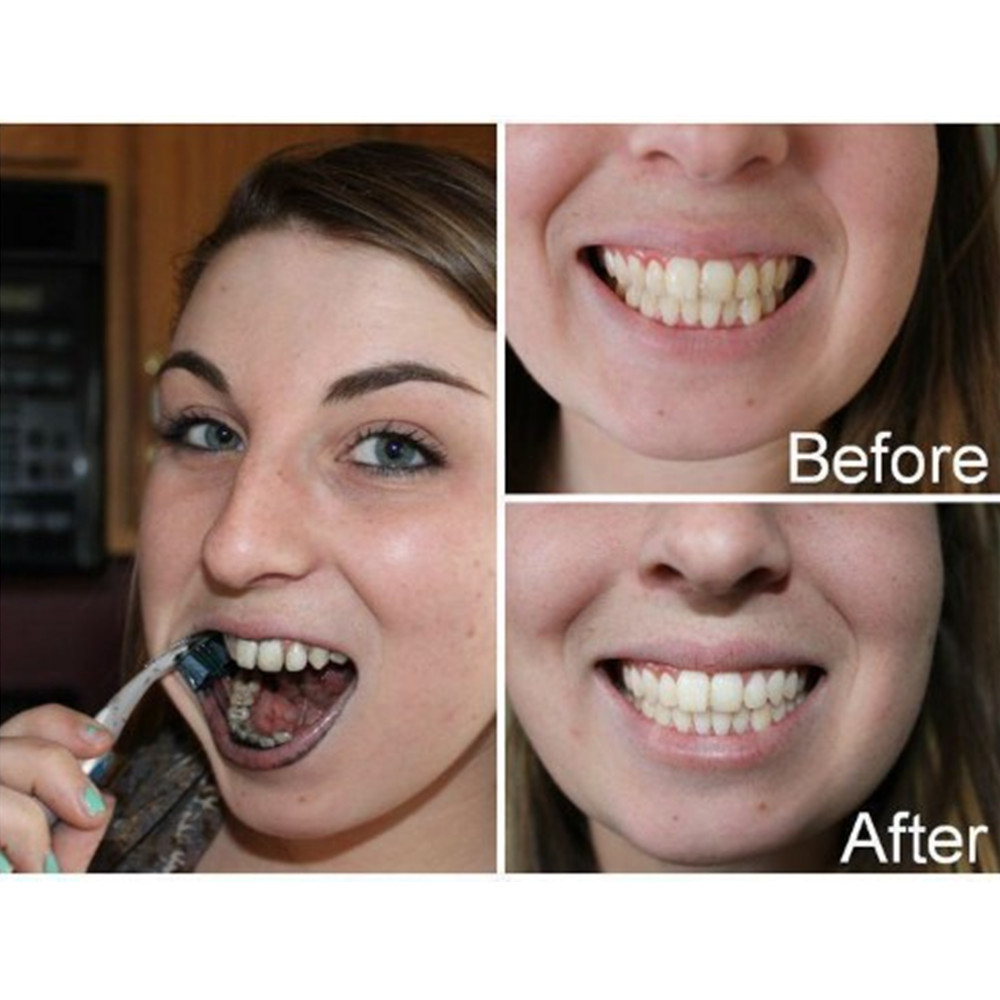 Bamboo Charcoal Teeth Tooth De - đánh giá và giá Teeth Whitening Ingredients