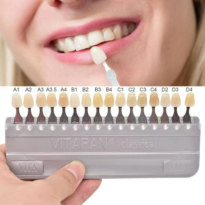 VITA 16 Colors Teeth Shade Gui - đánh giá và giá Teeth Whitening Kit Professional