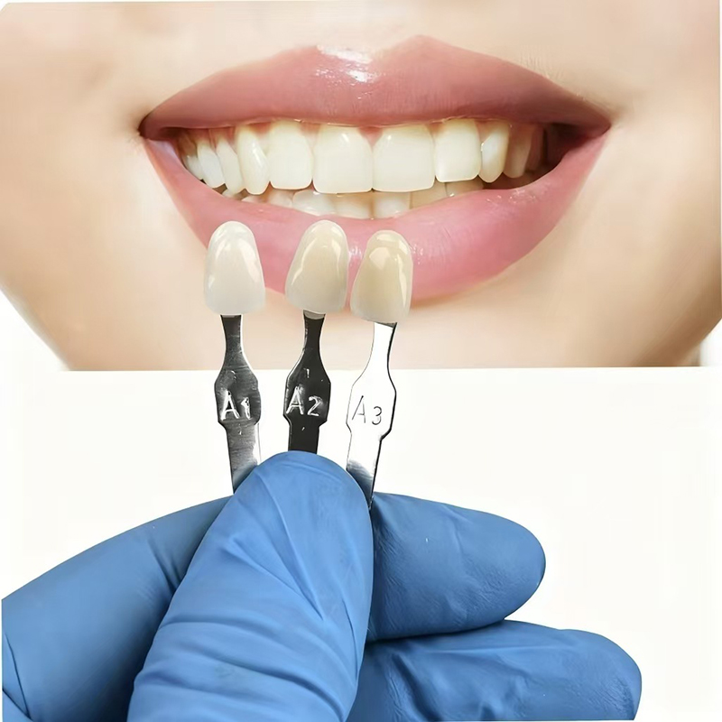 VITA 16 Colors Teeth Shade Gui - đánh giá và giá Teeth Whitening Kit Professional