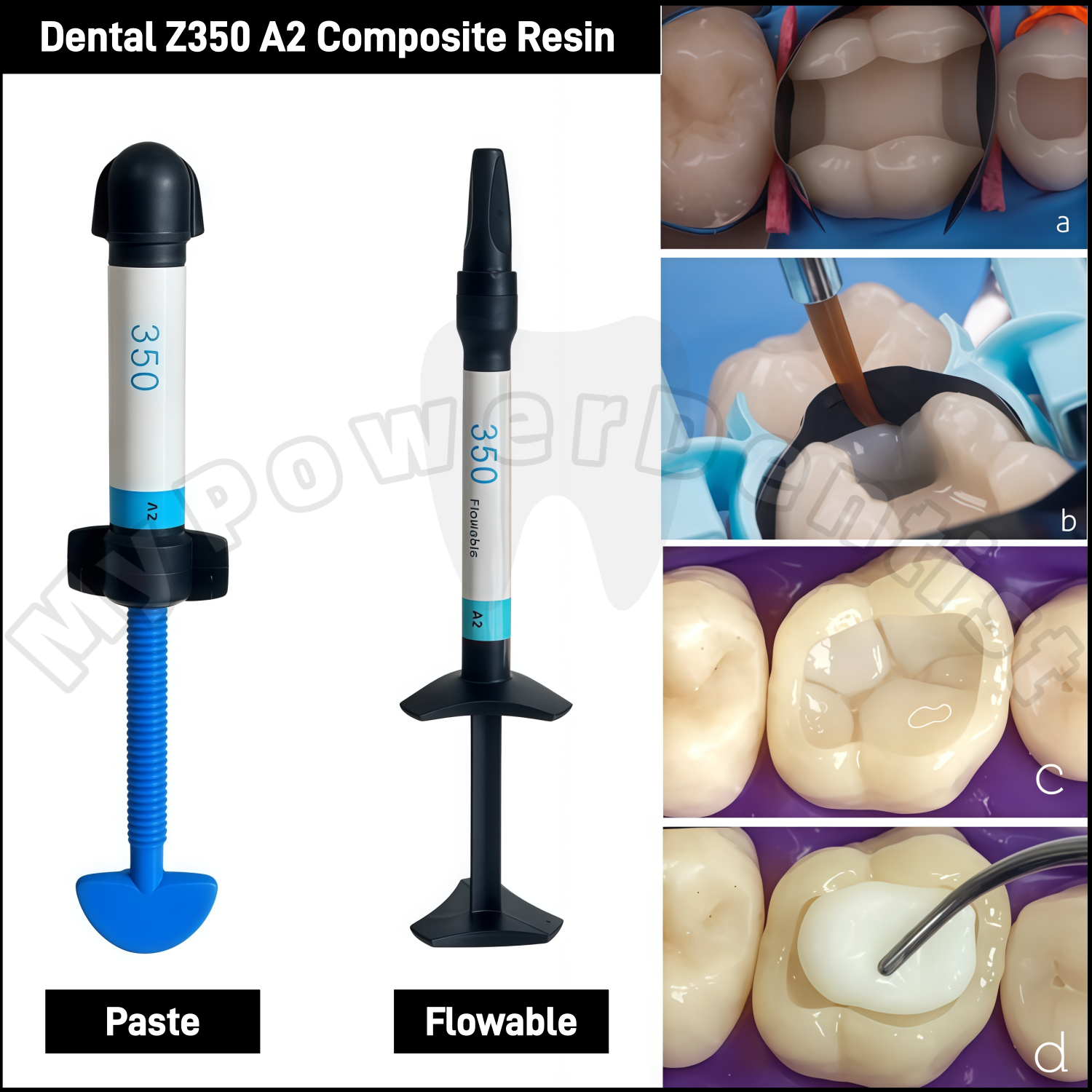 Z350 A2  Dental Composite Resi - đánh giá và giá Teeth Whitening Usa