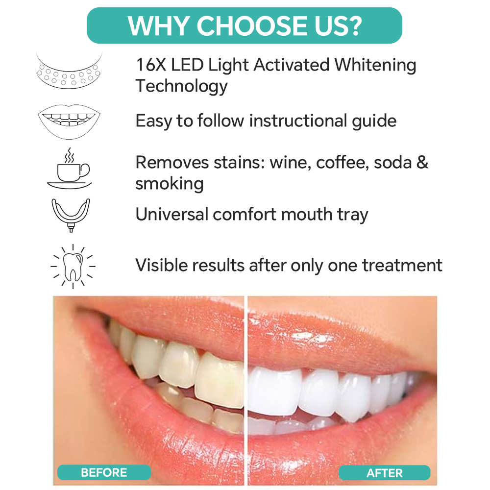 Teeth Whitening Accelerator Li - đánh giá và giá Teeth Whitening Bleach