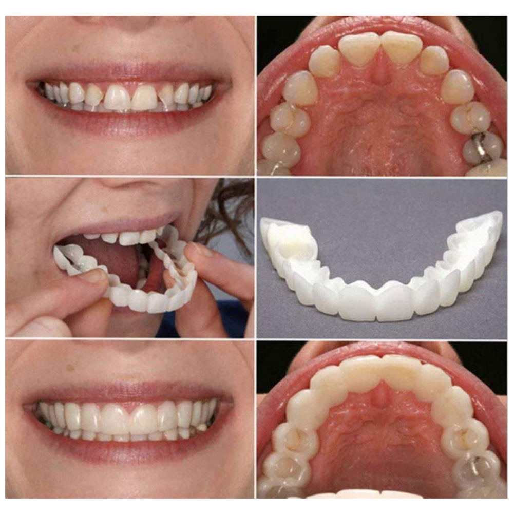 Silicone Denture Set Fit Tempo - đánh giá và giá Teeth Whitening Usa