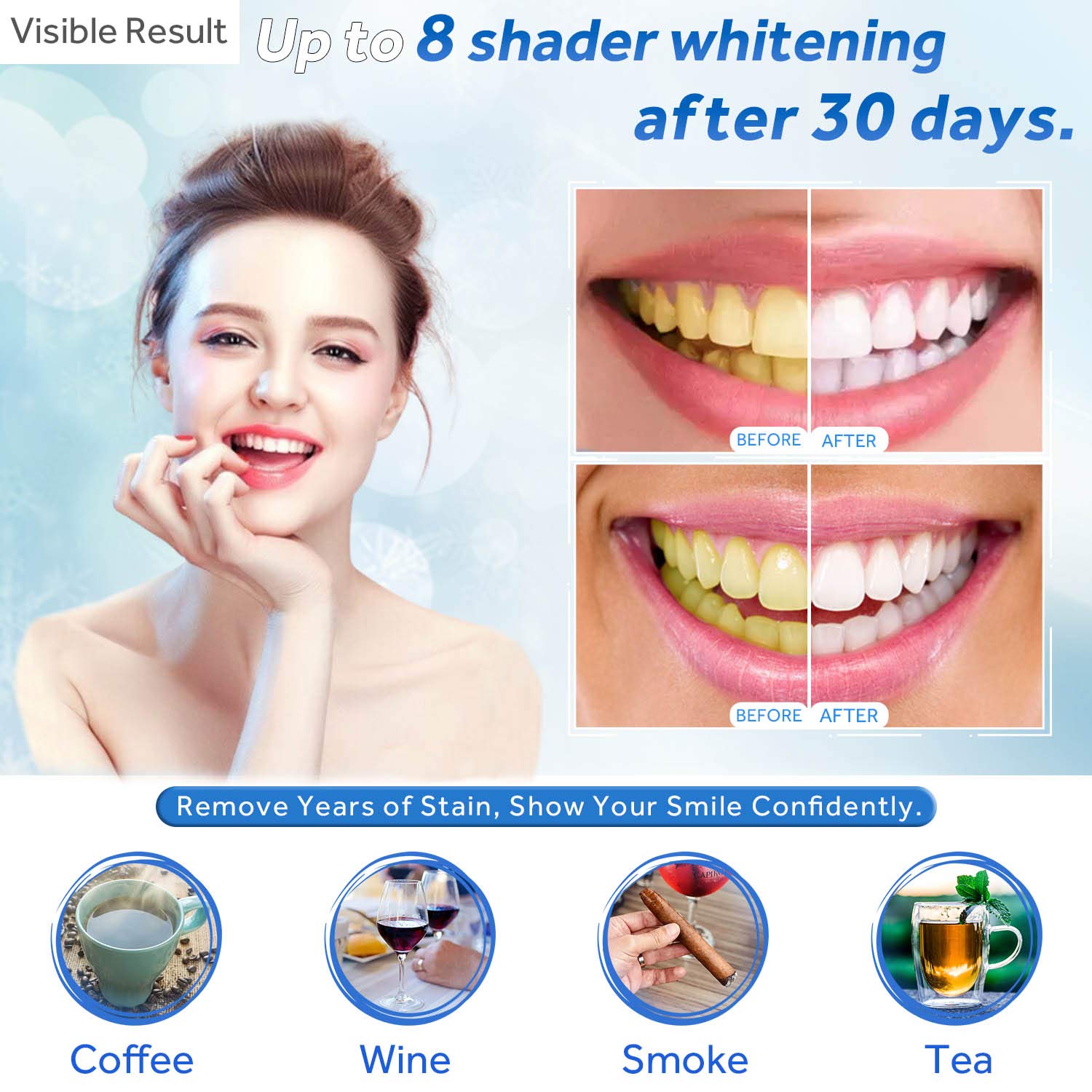 Teeth Whitening Gel Refill Syr - đánh giá và giá Teeth Whitening From Home