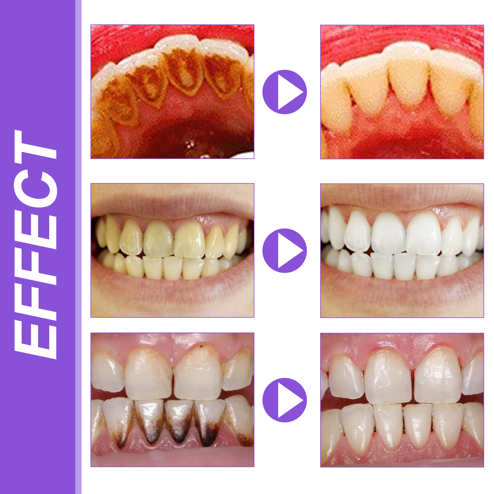 EELHOE Smiles Bright White Ref - đánh giá và giá Teeth Whitening Ingredients