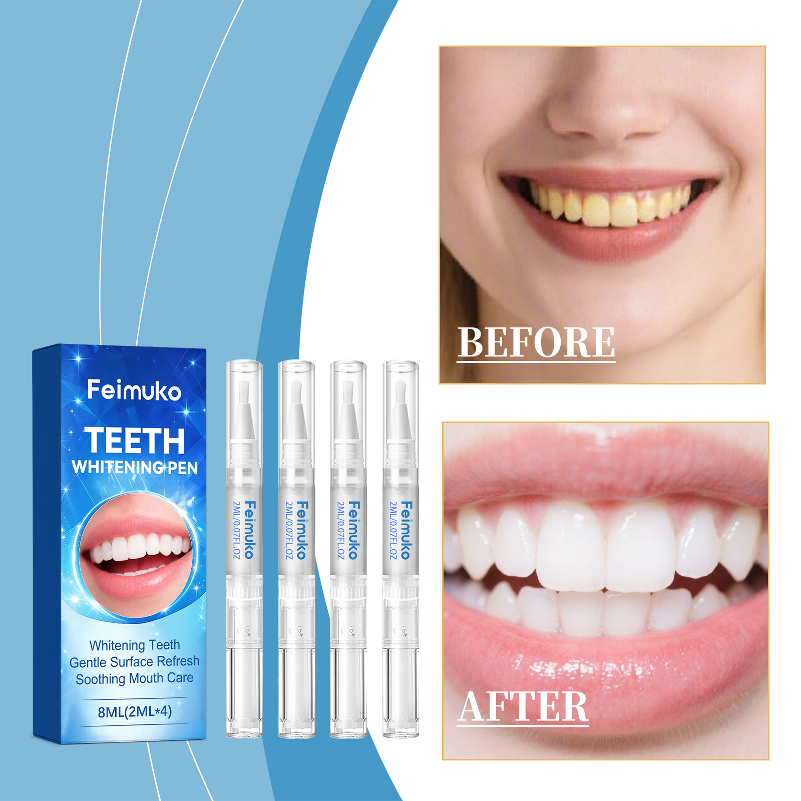 Feimuko 8ml Teeth Gel Pen Gent - đánh giá và giá Teeth Whitening From Home