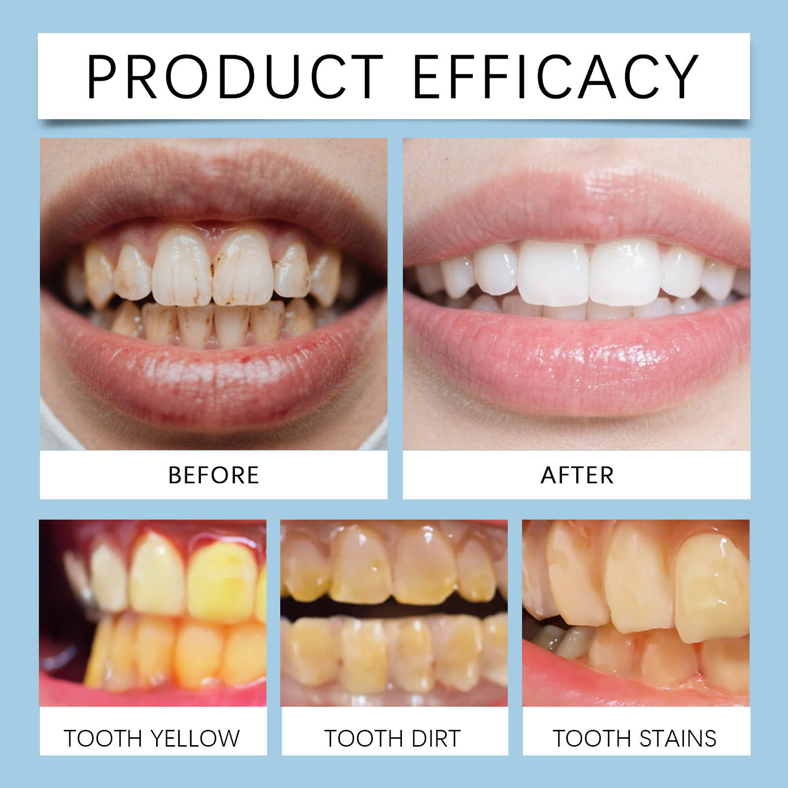 Feimuko 8ml Teeth Gel Pen Gent - đánh giá và giá Teeth Whitening From Home