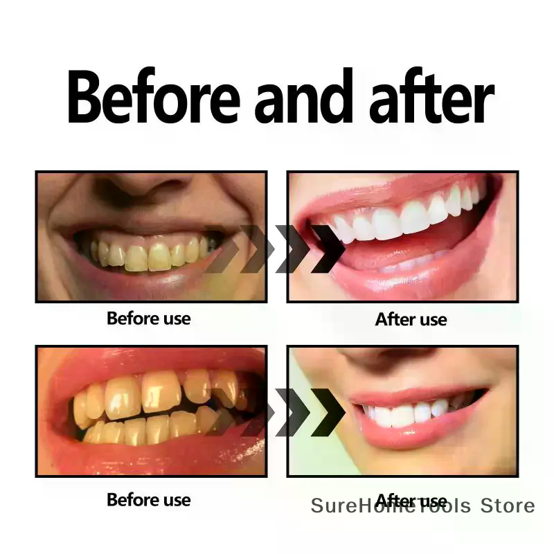 Bamboo Charcoal Powder For Tee - đánh giá và giá Teeth Whitening Ingredients