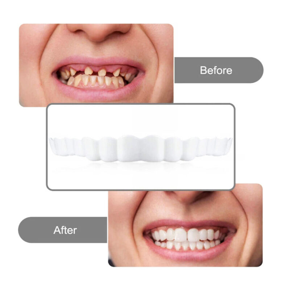 newSilicone Denture Set Fit Te - đánh giá và giá Teeth Whitening Usa
