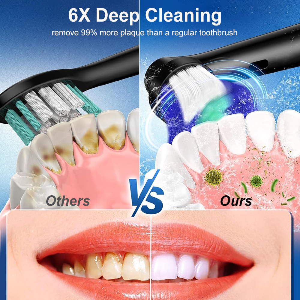 Electric Rotating Toothbrush D - đánh giá và giá Teeth Whitening Gel Refills