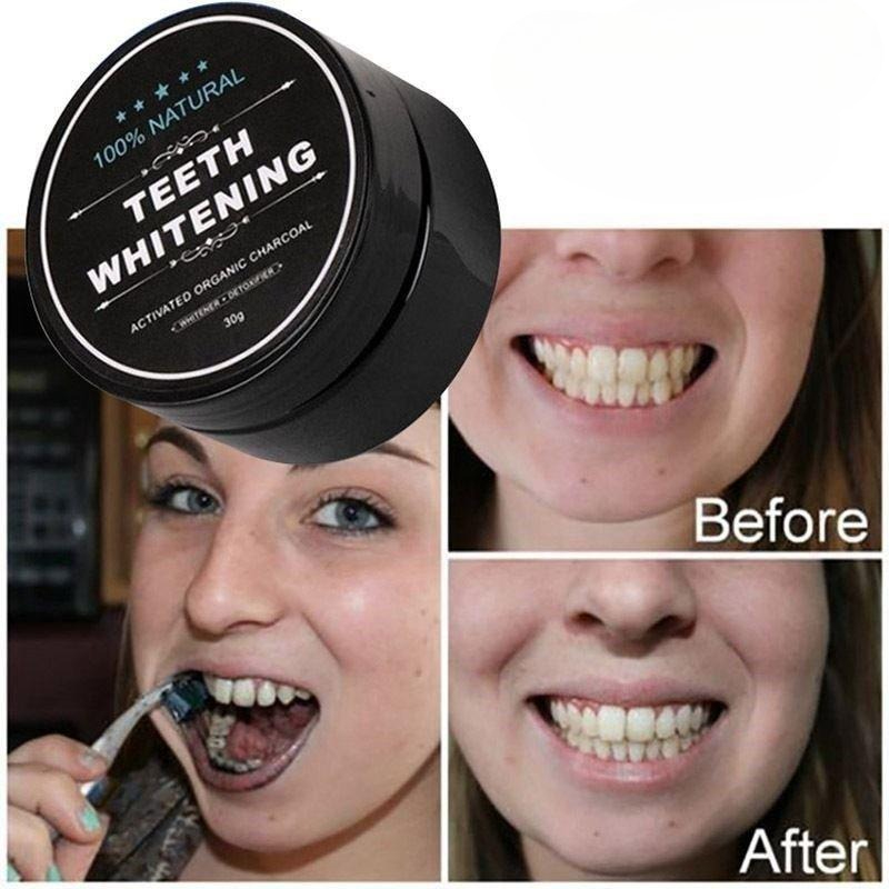 1 Box Activated Charcoal Teeth - đánh giá và giá Teeth Whitening Charcoal Powder
