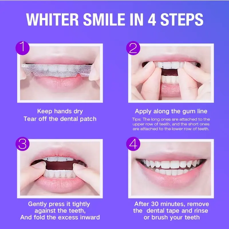 Teeth Whitening Kit - 5X LED L - đánh giá và giá Teeth Whitening Home Kit