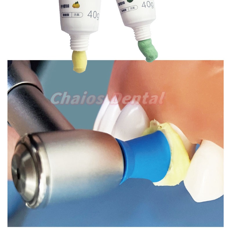 40g/Tube Dental Prophy Paste R - đánh giá và giá Teeth Whitening Youtube
