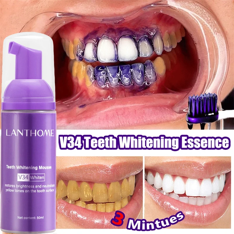 V34 Teeth Whitening Mousse Too - đánh giá và giá Teeth Whitening Bleach