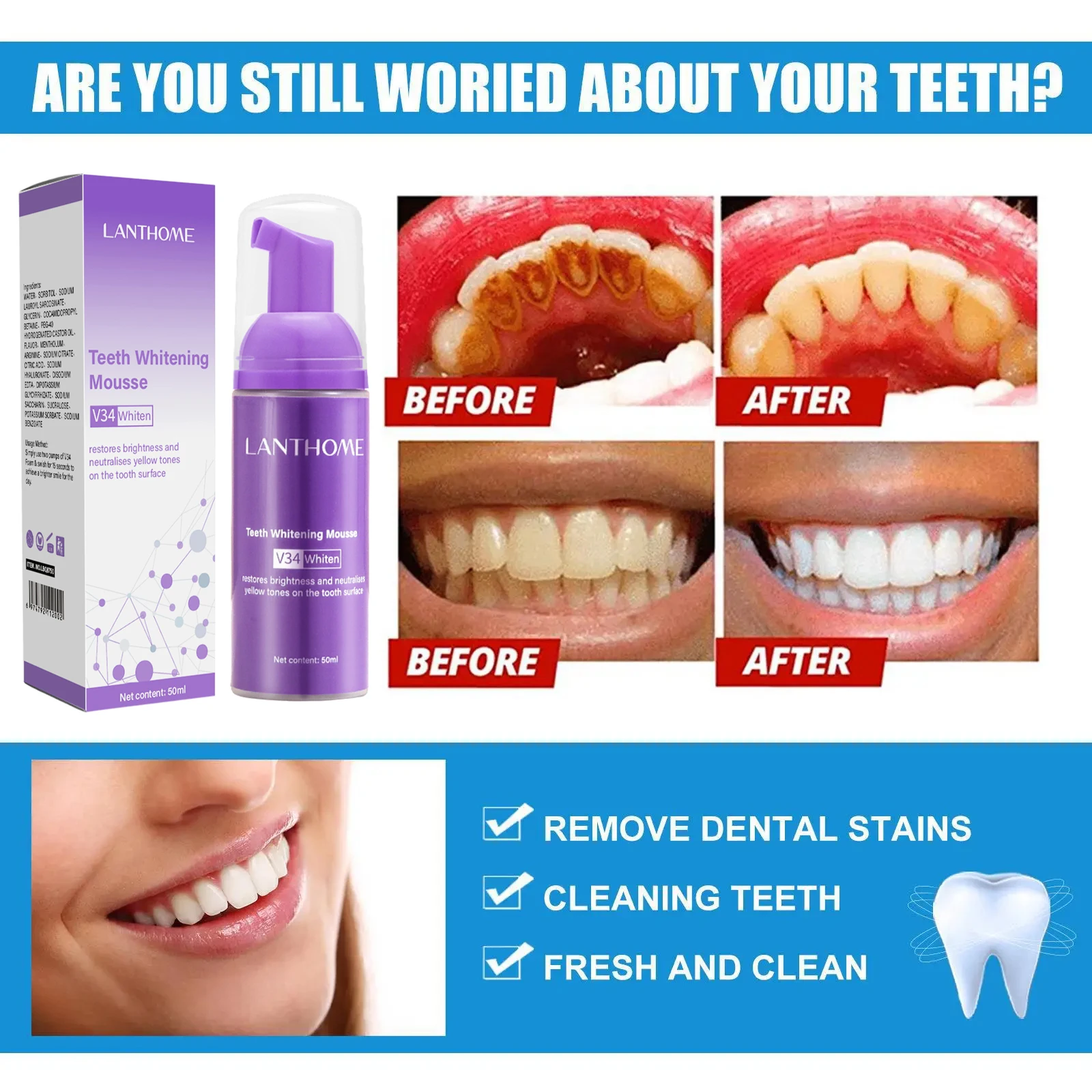 V34 Teeth Whitening Mousse Too - đánh giá và giá Teeth Whitening Bleach