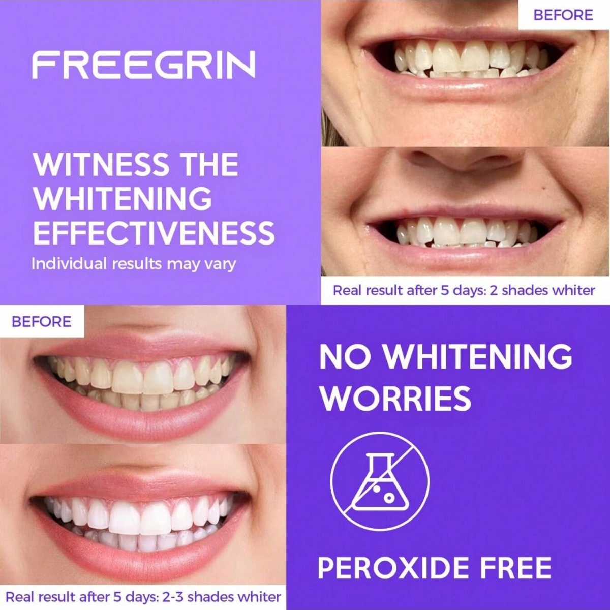 Deluxe Whitening Teeth Sticker - đánh giá và giá Teeth Whitening Gel Refills