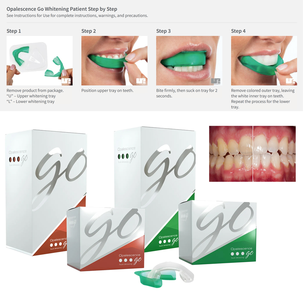 Opalescence Go Teeth Whitening - đánh giá và giá Teeth Whitening Home Kit