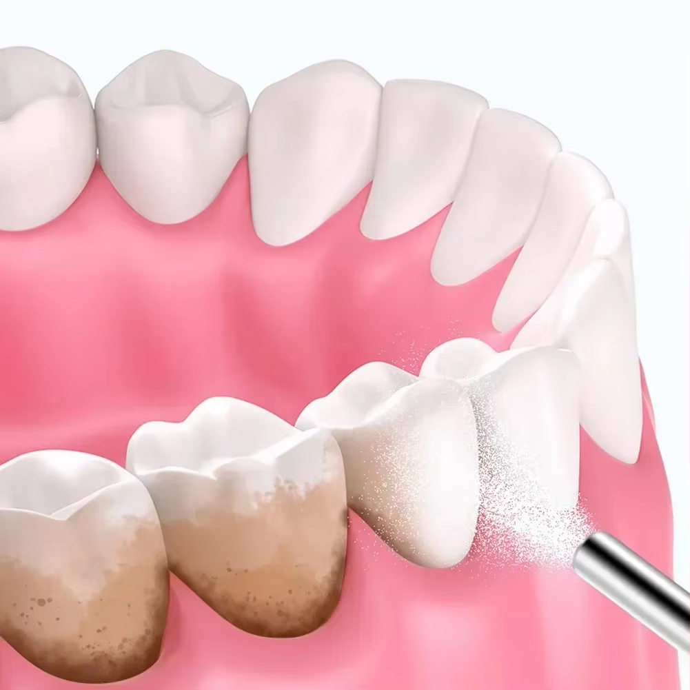 Dental Sandblasting Powder 500 - đánh giá và giá Teeth Whitening Ingredients