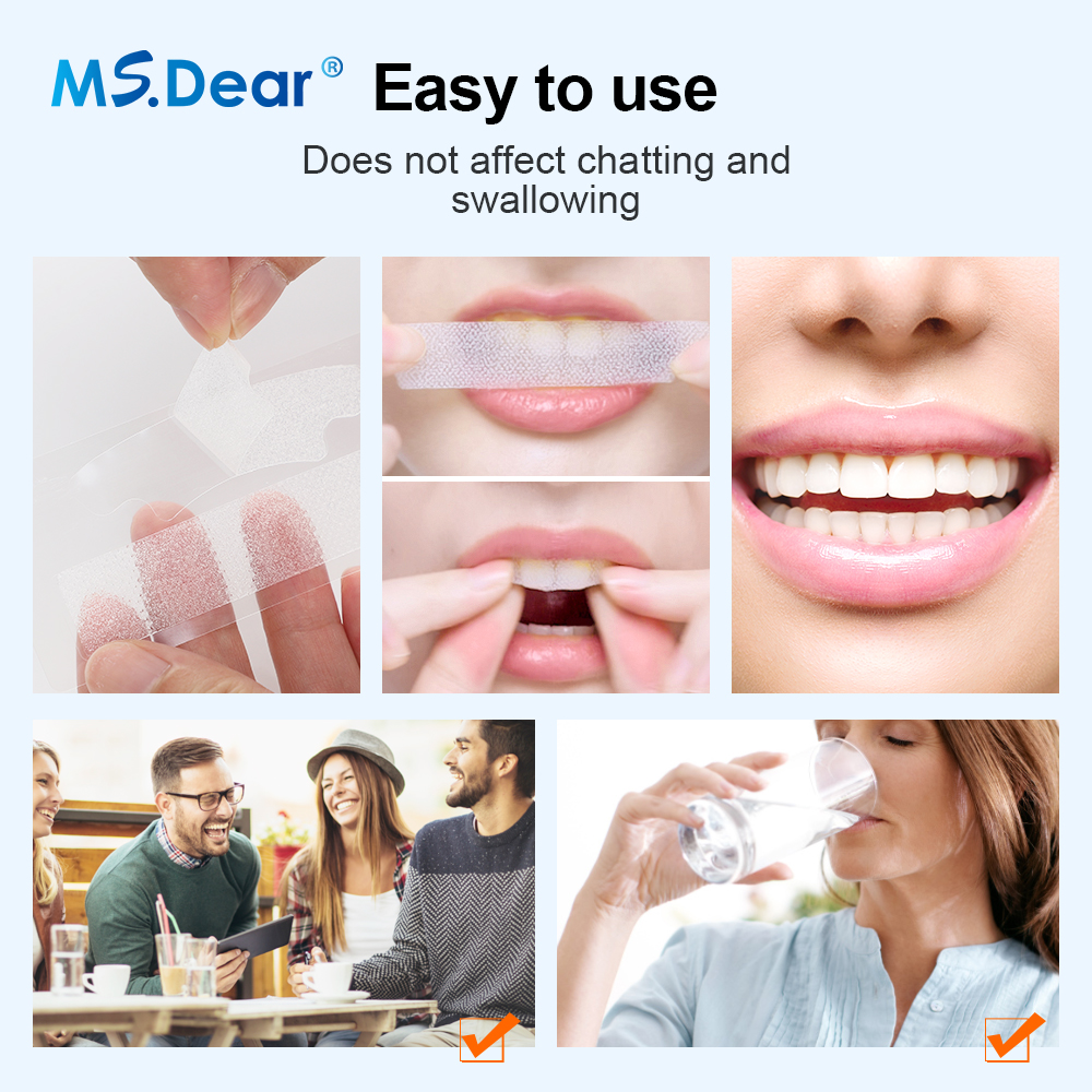 Teeth Whitening Strips Cleansi - đánh giá và giá Teeth Whitening Gel Refills